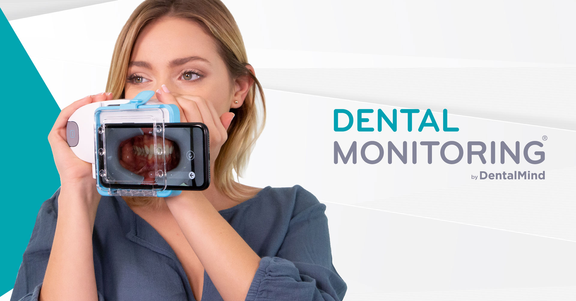 Dental Monitoring, Behandlungsmonitoring